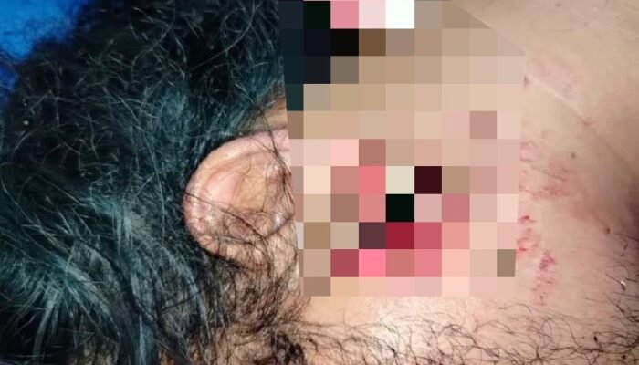 Pelaku Pengeroyokan Tak Kunjung Ditangkap, Korban Akan Demo Besar-besaran di Mapolrestabes Medan