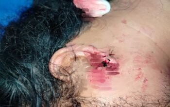 Para pelaku pengeroyokan terhadap RS (korban) yang terjadi di Live Musik Batak Song, Jalan Imam Bonjol Medan tak kunjung ditangkap Polrestabes Medan. RS menilai penyidik Satreskrim Polrestabes Medan tidak profesional