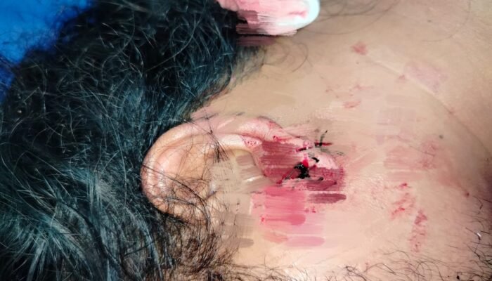 Proses Hukum Terkesan Lambat Dan Jalan Ditempat, Korban Sebut Penyidik Polrestabes Medan Tidak Profesional Dan Diduga Ada Kesengajaan