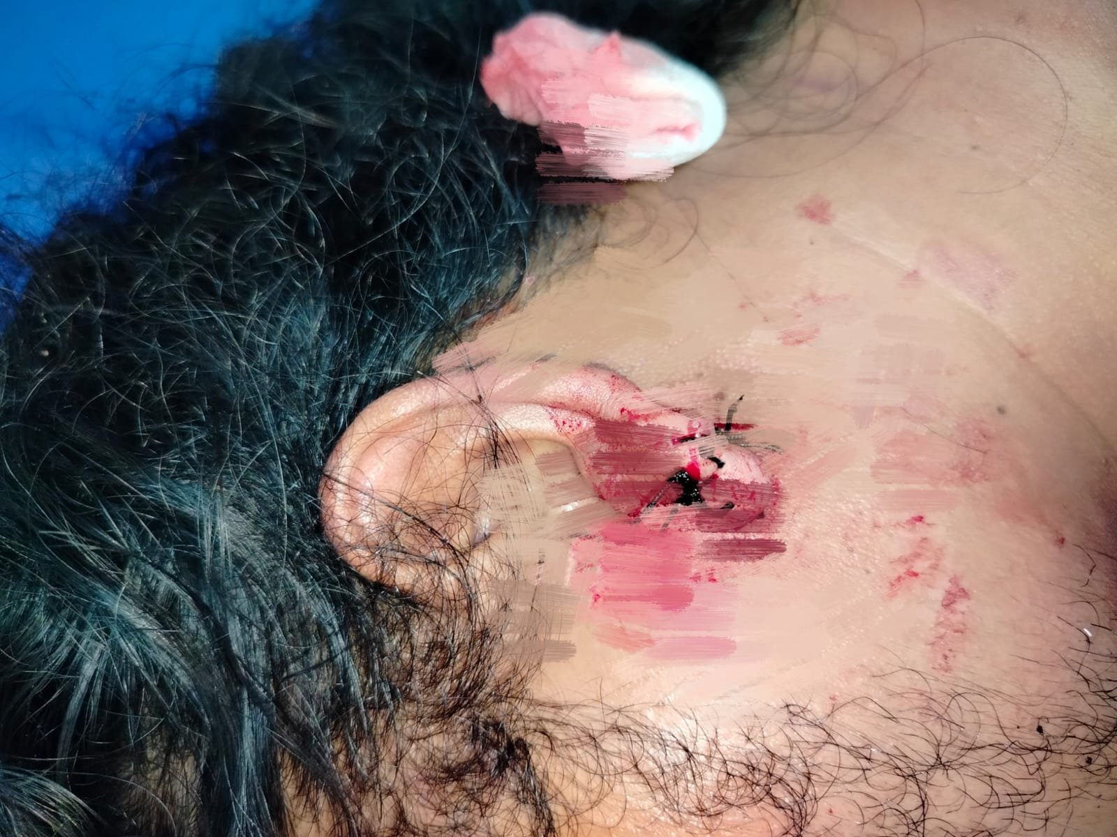 Para pelaku pengeroyokan terhadap RS (korban) yang terjadi di Live Musik Batak Song, Jalan Imam Bonjol Medan tak kunjung ditangkap Polrestabes Medan. RS menilai penyidik Satreskrim Polrestabes Medan tidak profesional