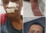 Sadis!!..Dibacok 3 Pemuda hingga Tendon Kaki Putus, Keluarga Arfan Desak Polisi Segera Tangkap Pelaku di Medan