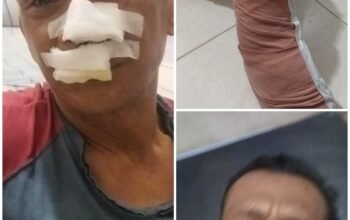 Sadis!!..Dibacok 3 Pemuda hingga Tendon Kaki Putus, Keluarga Arfan Desak Polisi Segera Tangkap Pelaku di Medan