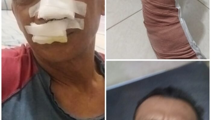 Sadis!!..Dibacok 3 Pemuda hingga Tendon Kaki Putus, Keluarga Arfan Desak Polisi Segera Tangkap Pelaku di Medan