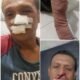 Sadis!!..Dibacok 3 Pemuda hingga Tendon Kaki Putus, Keluarga Arfan Desak Polisi Segera Tangkap Pelaku di Medan