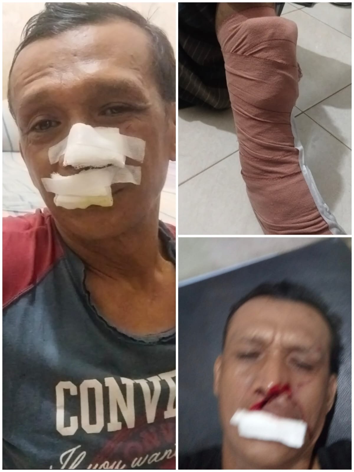Sadis!!..Dibacok 3 Pemuda hingga Tendon Kaki Putus, Keluarga Arfan Desak Polisi Segera Tangkap Pelaku di Medan