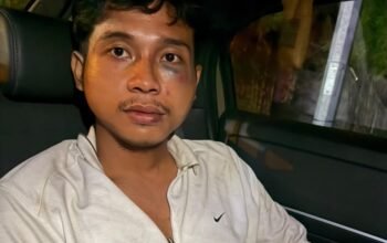 Dianiaya Teman Mantan Pacar dan Diancam Pisau, Fadlan Lapor ke Polrestabes Medan