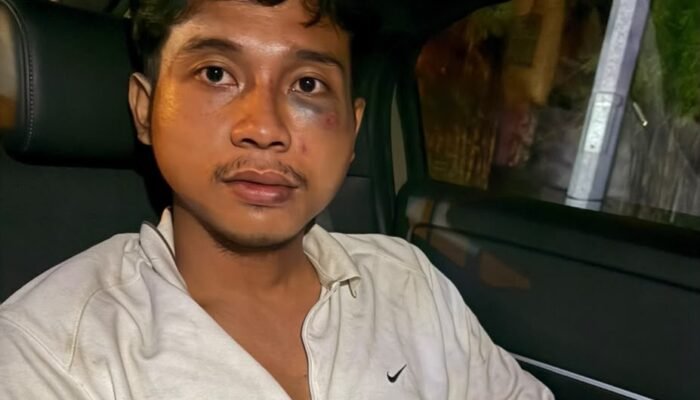 Dianiaya Teman Mantan Pacar dan Diancam Pisau, Fadlan Lapor ke Polrestabes Medan