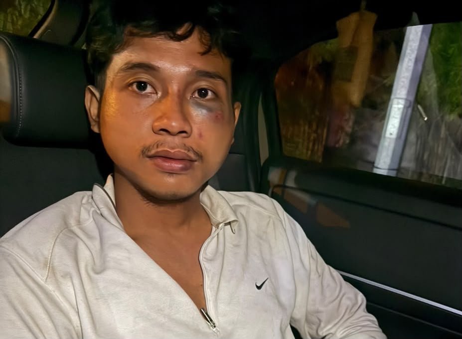 Fadlan Hartono menunjukkan luka yang dialaminya setelah mengaku menjadi korban dugaan penganiayaan dan ancaman senjata tajam di Medan.